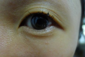 eye with remover